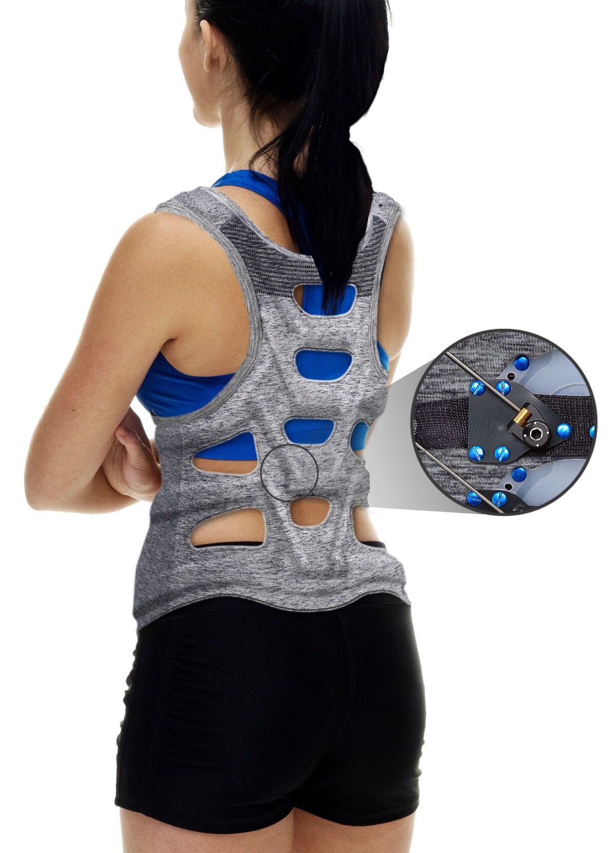 Green Sun Medical Wins $50,000 For Research On Dynamic Scoliosis Brace ...